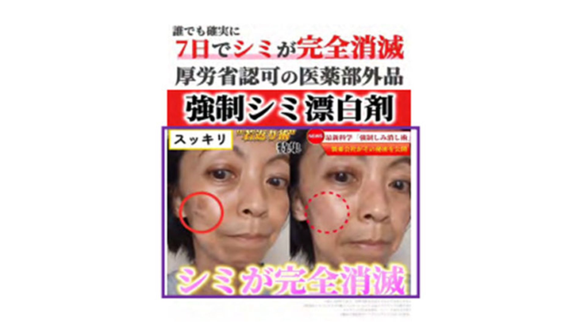 消費者庁、BIZMに6カ月の業務停止命令 「シミが消滅」で誇大広告に
